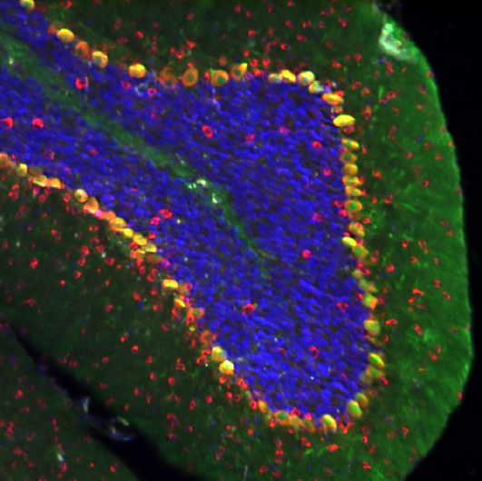 Patel Lab ID Image